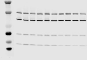 Lire la suite à propos de l’article Il était une fois dans l’ Western Blot…